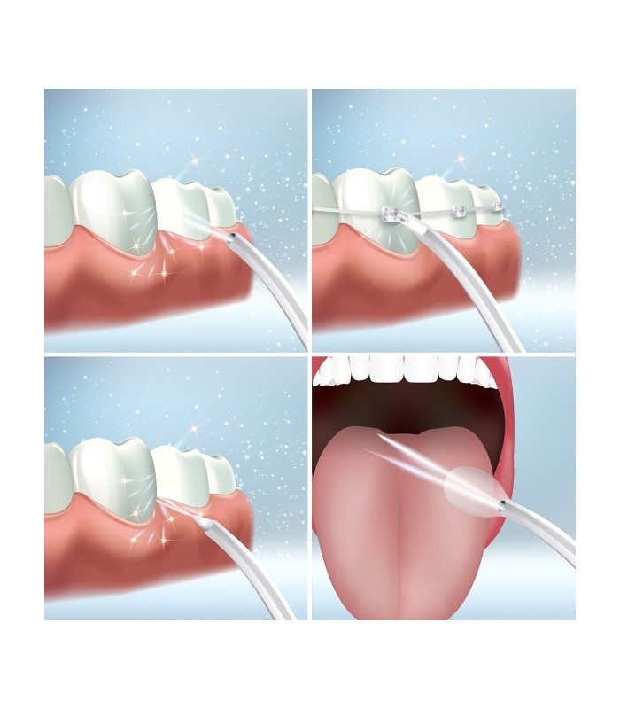 Jet dentaire sans fil Buccal pour soins quotidiens