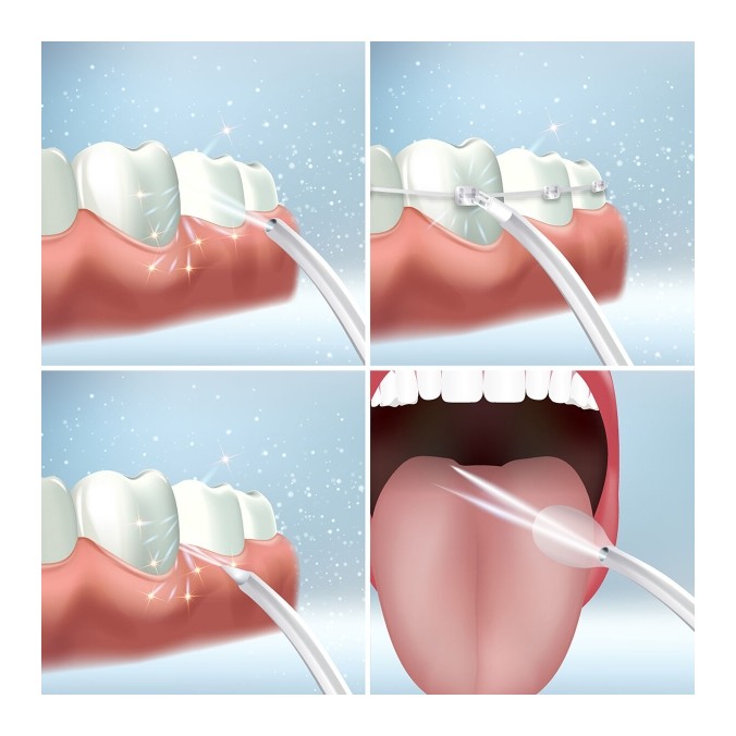Jet dentaire sans fil Buccal pour soins quotidiens